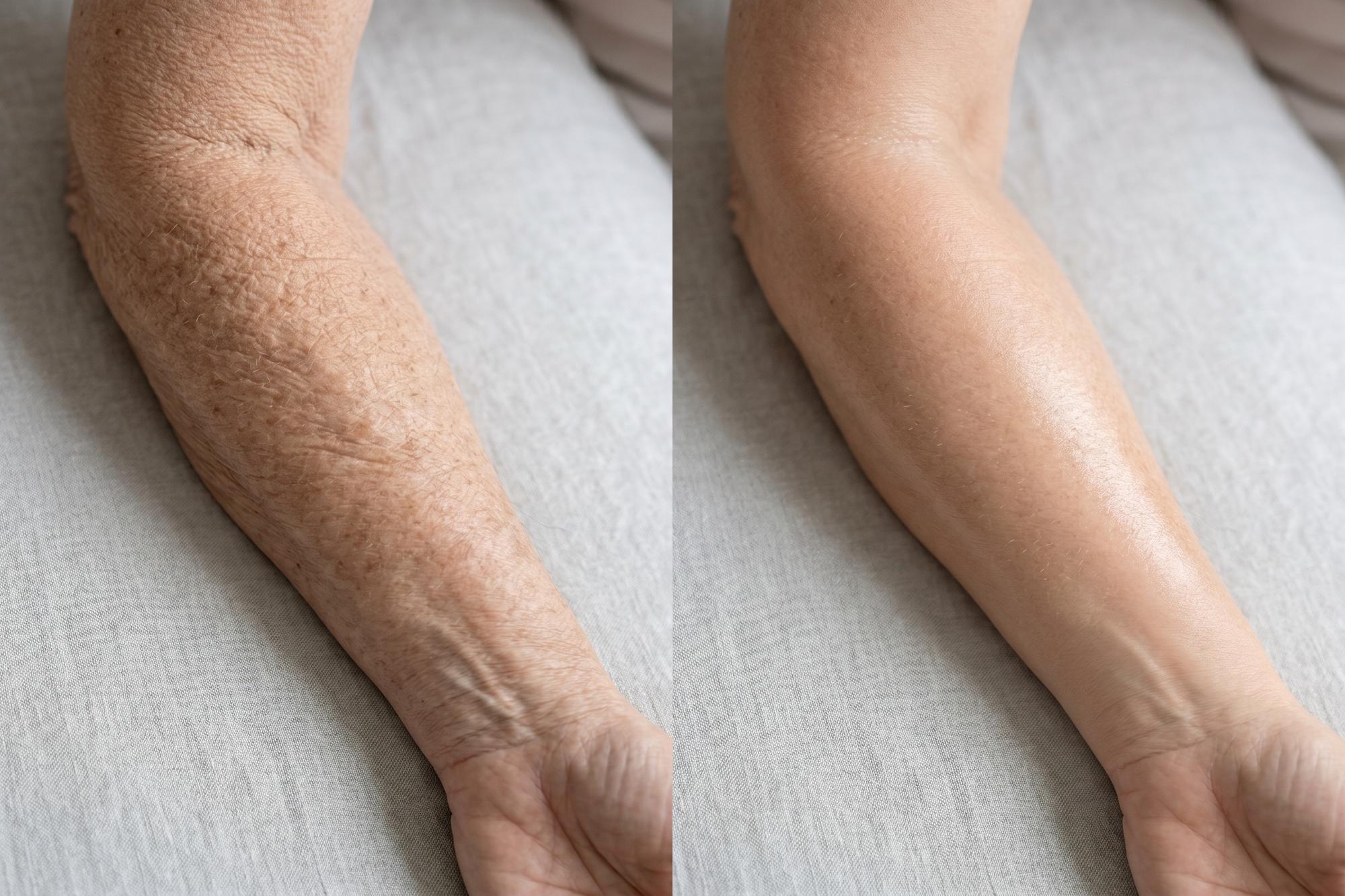 Before and After Results with Cavo Glow Body Oil